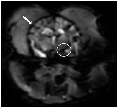Comparison of computed tomography perfusion and magnetic resonance dynamic susceptibility contrast perfusion-weighted imaging in canine brain